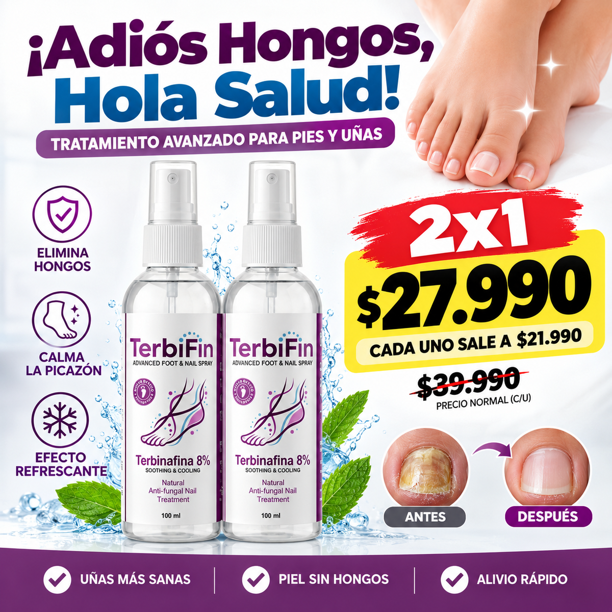TerbiFin Spray Antihongos para Pies y Uñas | Cuidado Antifúngico Avanzado